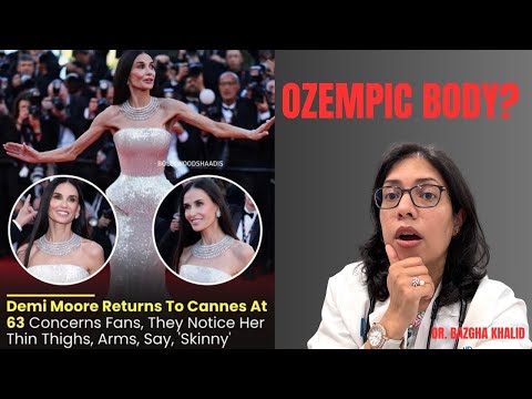 Ozempic Arm & Body Is Real —Weight Loss Doctor Explains What's Actually Happening to Your Body
