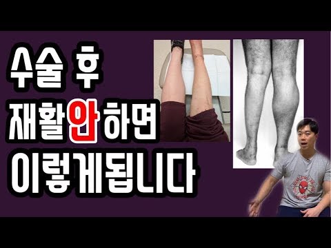 수술후재활 꼭 해야하는 이유(수술후관리/근손실/재활운동/물리치료사)