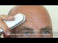 How the jenu infuser works on forehead wrinkles