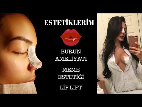 HER YERİM ESTETİK ?! | Burun Estetiği, Göğüs Estetiği | Kaç Estetiğim Var?