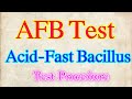 #AFB_Test (Acid-Fast Bacillus) Test Procedure