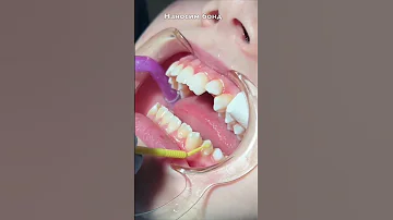 Сколько дней прикрепляют к стоматологии