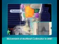 What is the difference between IMRT & conventional radiotherapy?