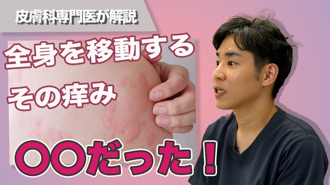 全身を移動するその痒み〇〇だった！