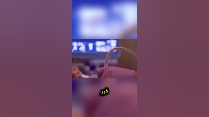 كانت هذه السيدة تعتقد أنها حامل لكن ما اكتشفه الأطباء كان مخيفاً حقاً😱