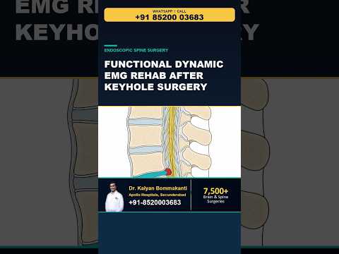 Functional Dynamic EMG Rehab After Keyhole Surgery - Best Spine Surgeon in Hyderabad