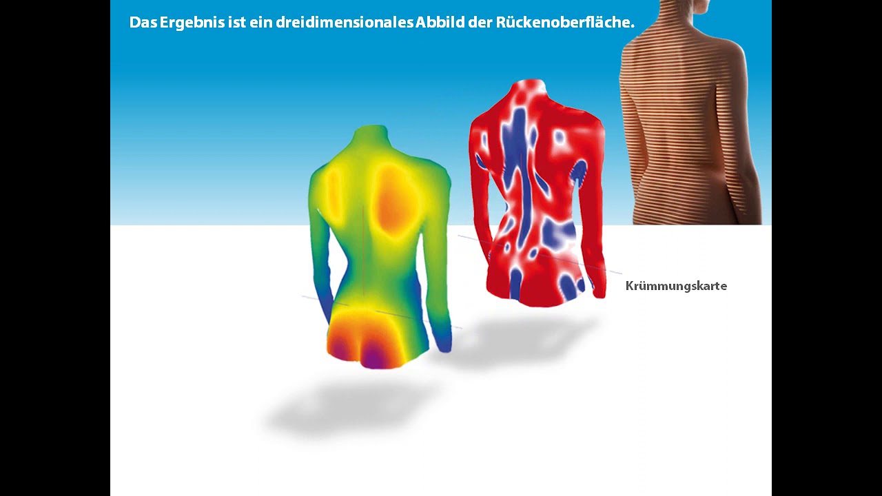 4D Wirbesäulenvermessung   Zentrum für integrative Medizin