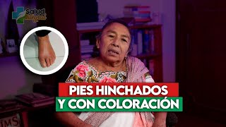 #TESTIMONIO DOÑA ROSALÍA TENÍA NEUROANGIOSIS.