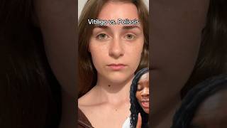 Famous Why are her natural lashes two different colors? #eyemakeup Wealth