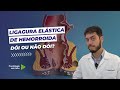 Ligadura elástica doi ou não doi? Ligadura elástica de hemorroidas.