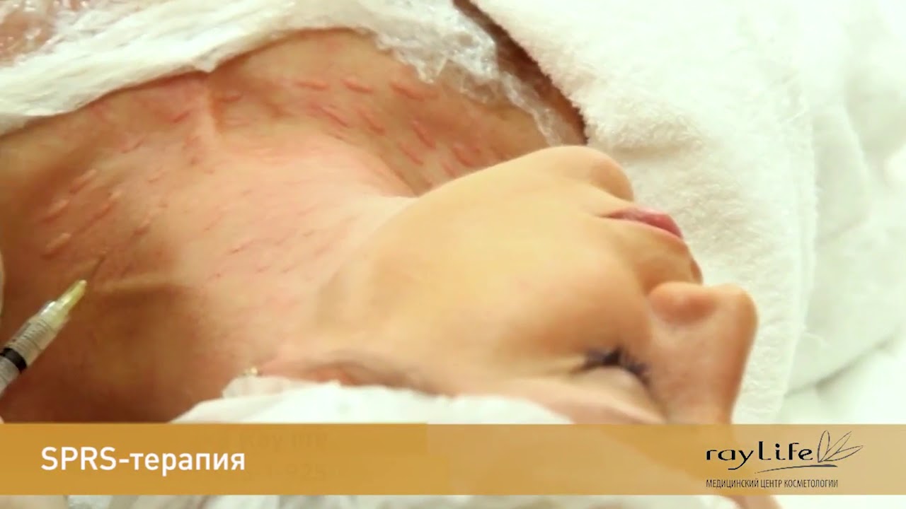 SPRS-терапия. Клеточная косметология