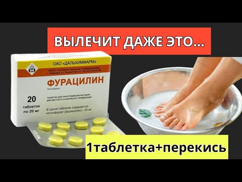 Даже никто НЕ ДОГАДЫВАЕТСЯ,что ФУРАЦИЛИН способен на такое! Что ТВОРИТ Фурацилин.