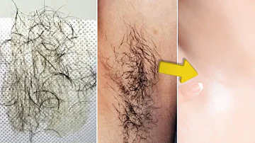 Wie kann man Haare entfernen ohne das es wieder wächst?