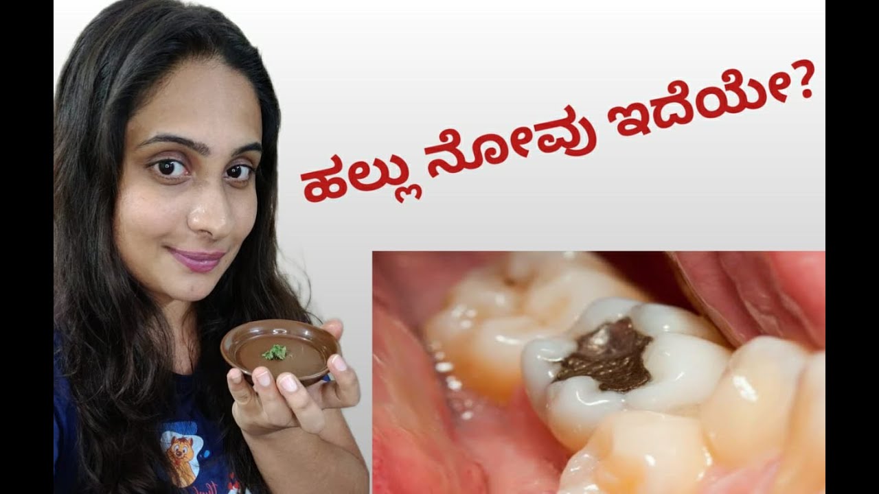ಹಲ್ಲು ನೋವಿಗೆ ಶಾಶ್ವತ ಪರಿಹಾರ Permanent solution for teeth pain home