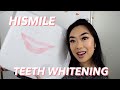 HISMILE TEETH WHITENING (results after 6 days)