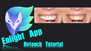 Enlight iPhone App |  Teeth Whitening screenshot 5