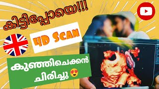 കിട്ടിപ്പോയെ!!! കുഞ്ഞിചെക്കൻ ചിരിച്ചു | UK pregnancy 4D scan| Malayalam vlog | Daffodil Couple
