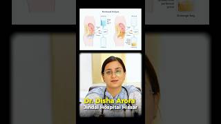 Methods of Peritoneal Dialysis #dialysis #generalphysician
