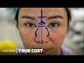 The fake doctors behind asias cosmetic surgery boom  true cost  insider news