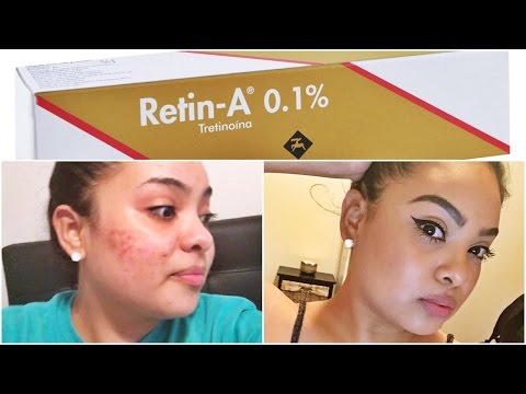 HOW TO GET CLEAR SKIN! Get Rid of ACNE + DARK SPOTS Using RETIN-A Cream