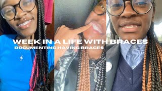 DOCUMENTING A WEEK IN A LIFE WITH BRACES😬 screenshot 5