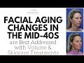 Why the Biggest Facial Aging Issue in the Mid-40s in Volume Loss and Skin Quality, Not Sagging