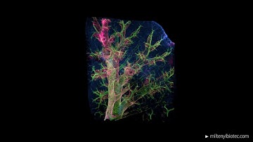 Light sheet microscopy image of identifying tumor target sites for effective therapies