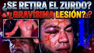 Zurdo Ramírez y una posible lesión que podría obligarlo al retiro de confirmarse...