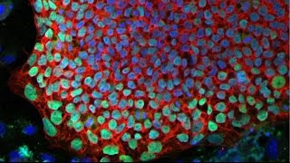 Salk Research Offers Hope For Bubble Boy Disease