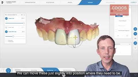 Tip of the Day: Using Snap to Biojaw