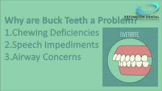 Detailed Buck Teeth Details
