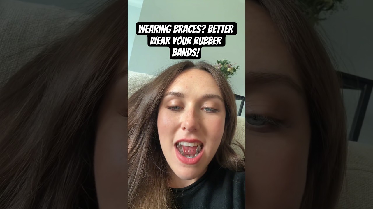 If you wearing braces better wear your rubber bands or you will get this... 