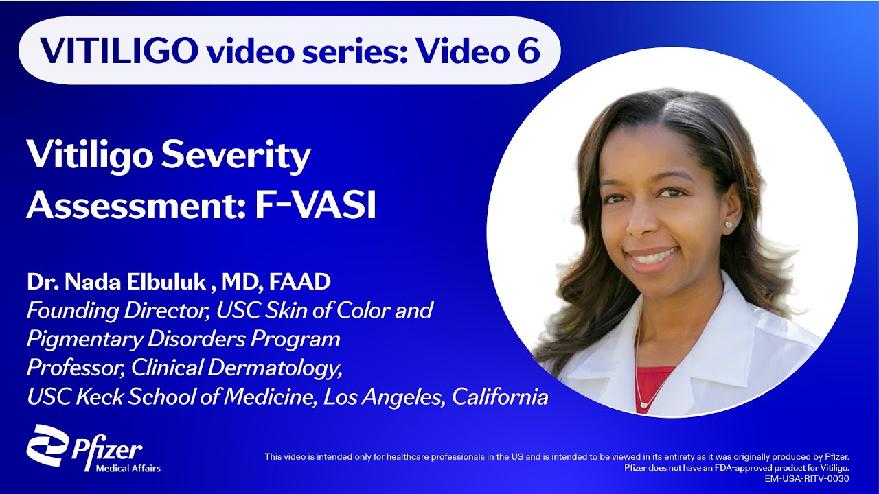 Vasi Rater Training Vitiligo Severity Assessment: Understanding F‑VASI - YouTube