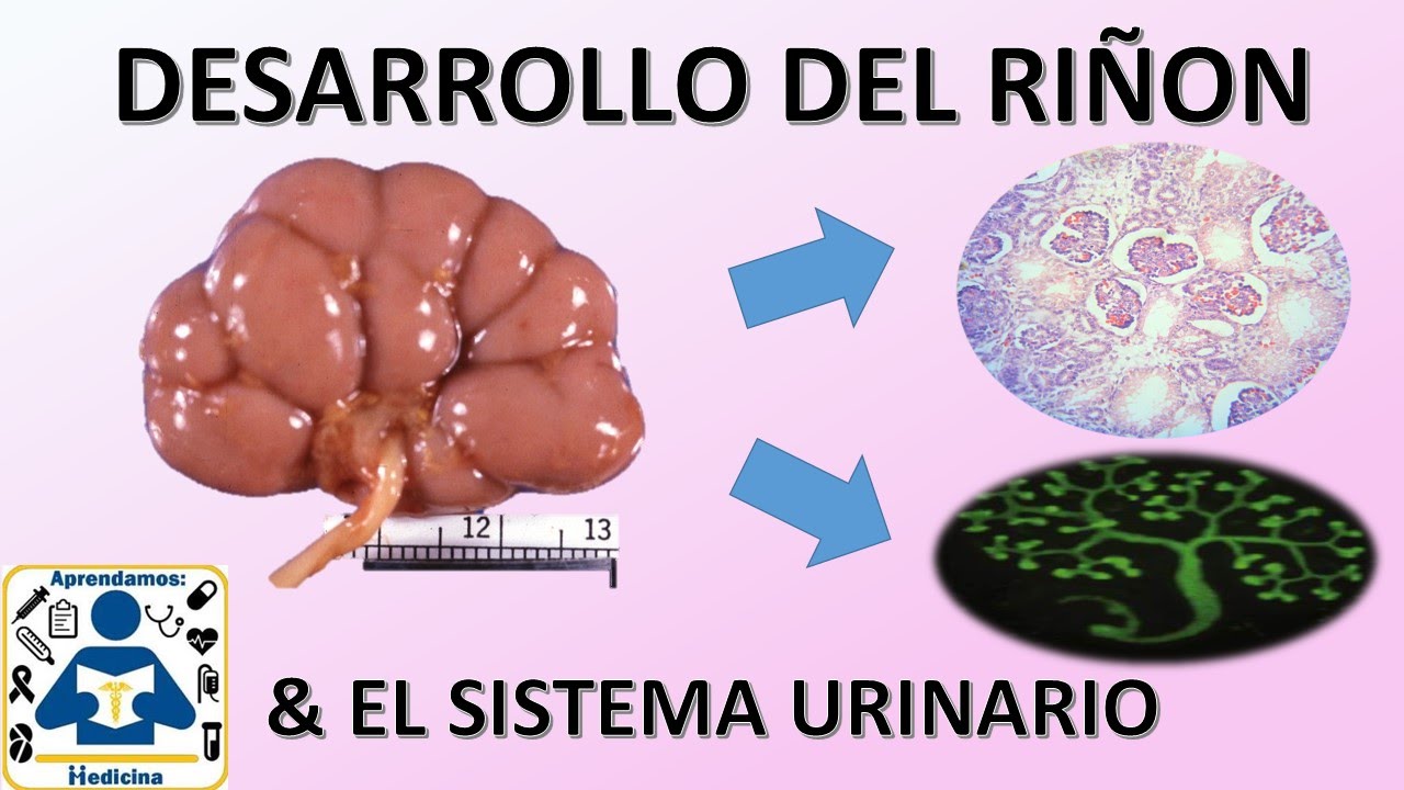 Embriologia: Desarrollo del Sistema Urinario/Renal - YouTube