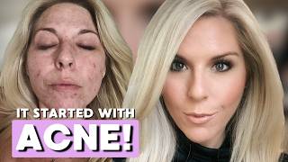 Celebrity Symptoms I Ignored Were STAGE 4 Pancreatic Cancer WARNING SIGNS! Net Worth