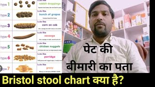 #bristol stool chart मल लैट्रिंग को देखकर जाने पेट की सारी बीमारी @Dr.hcp.medical