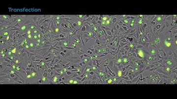 Time-lapse video of BacMam transfected HeLa cells - CytoSMART Omni FL fluorescence imager