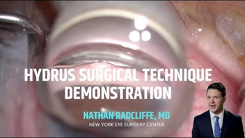 Hydrus Surgical Technique Demonstration with Dr. Nathan Radcliffe