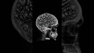 [FREE] FREESTYLE BEAT - "X-RAY" | TRAP INSTRUMENTAL 2026 | FREE RAP TYPE BEAT