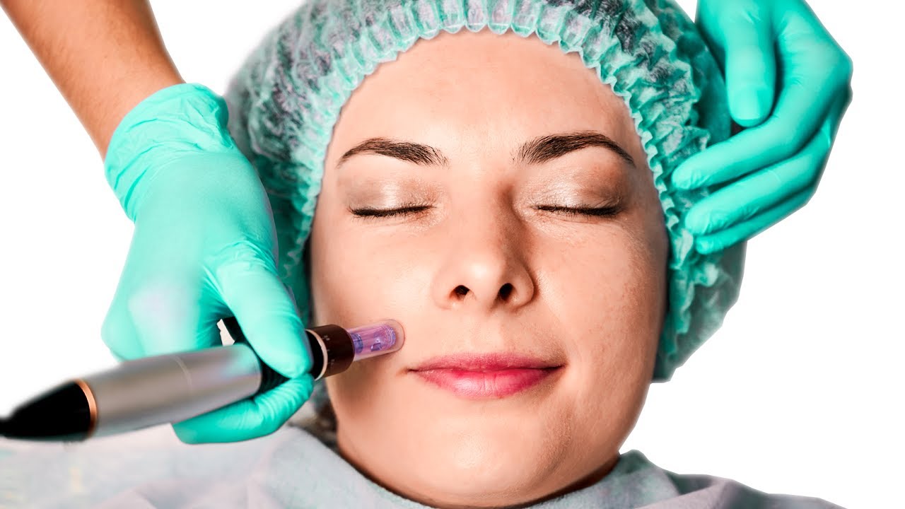 Microneedling for Younger Face and Body