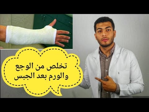 علاج الوجع والورم بعد الجبس