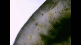 I put a prickly jingle under a microscope, and I didn't expect this to looks like that!