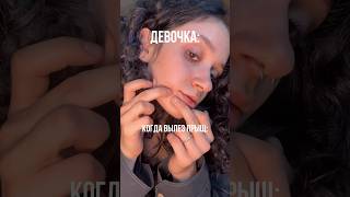 артикул - #WW129709 спасибо тому, кто придумал этот крем🙏🏻 #высыпания #акне #кремотпрыщей РП