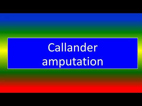 callander amputation by Medical Knowledge Online
