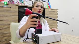 Qanayan Daxili Babasillərin Infra Qırmızı Lazerlə Əməliyyatı