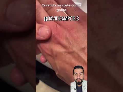 HERIDA CON PEGAMENTO
