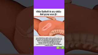 #bestyoutuber #subscribe #doctor #girls #woman #allfeed #viral #views #support #status #streamer