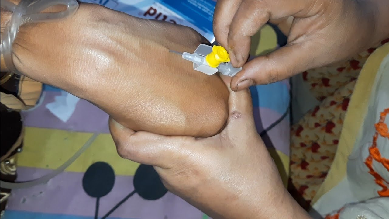 Cannula push & স্যালাইন করার ফুল প্রসেস Tutorial Ep- 127