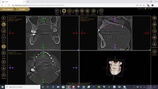 Training: Apteryx XVWeb 3D: Using Labels