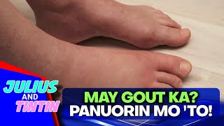 Gout: sintomas, sanhi, gamutan, risk factors